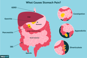 Why Does My Stomach Hurt? Unraveling the Causes of Abdominal Discomfort