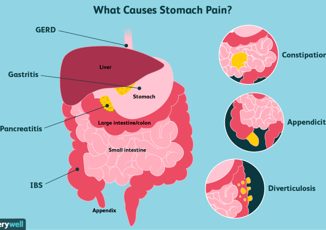 Why Does My Stomach Hurt? Unraveling the Causes of Abdominal Discomfort